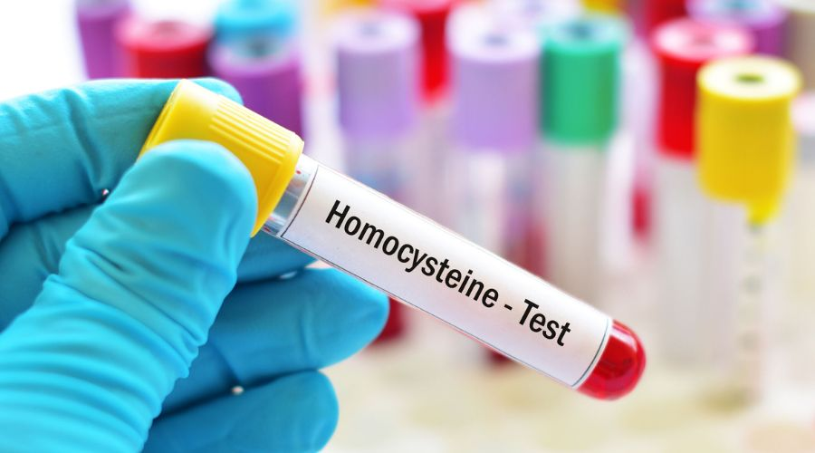 homocystéine