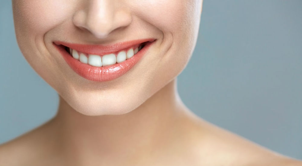 Un sourire d'une femme avec des dents blanches