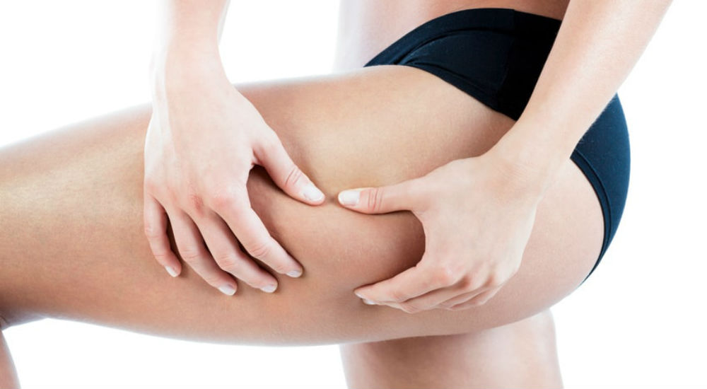 Les solutions naturelles anti-cellulite